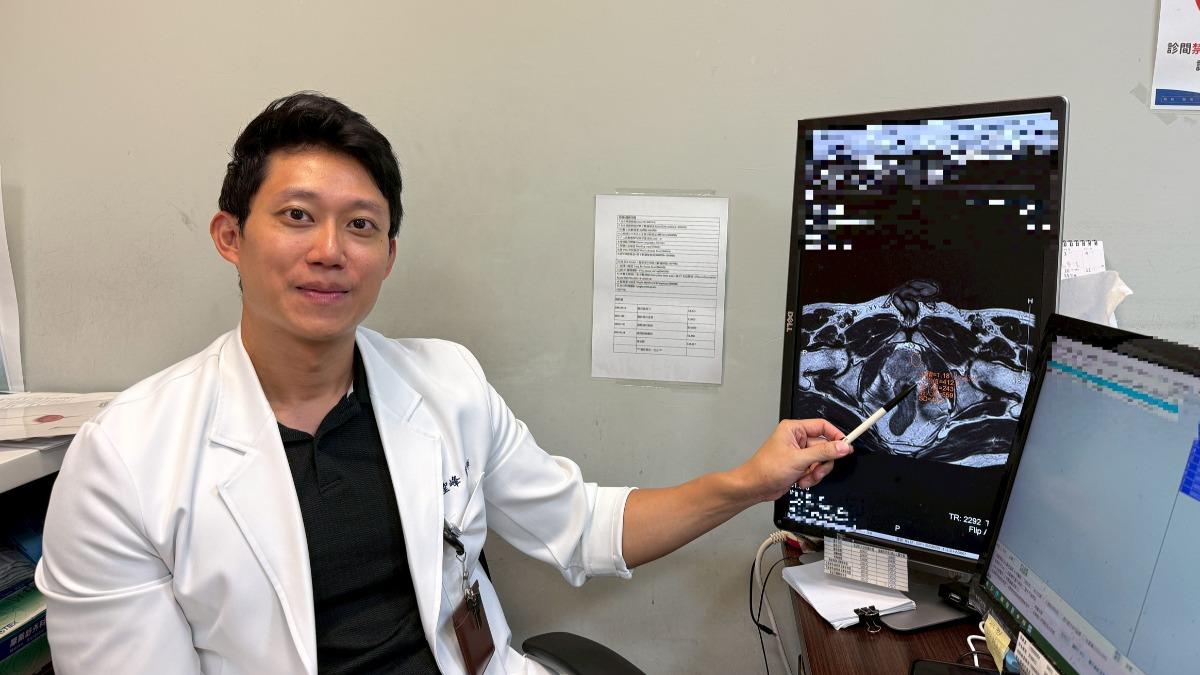 周聖峰指出,攝護腺癌為國內男性第三大癌症,是發生率增加比例最高的癌症。(圖/長安醫院提供)