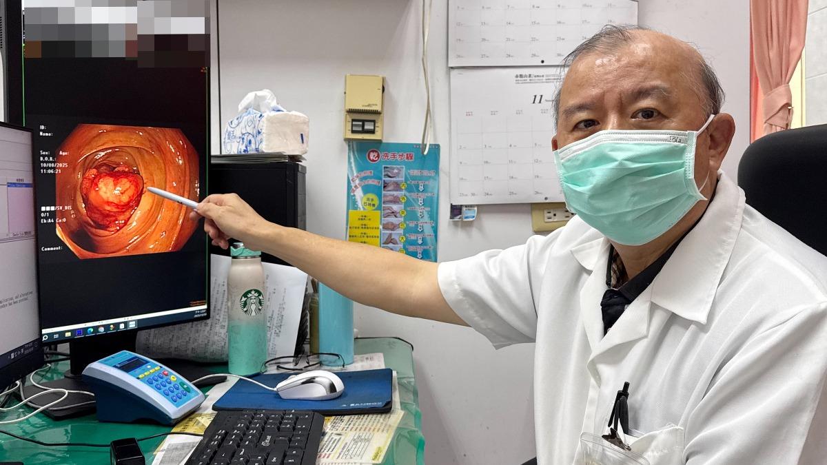 賴大豊進一步說明，大腸癌初期症狀不明顯，且不少人不會特別在意。（圖／大甲李綜合醫院提供）