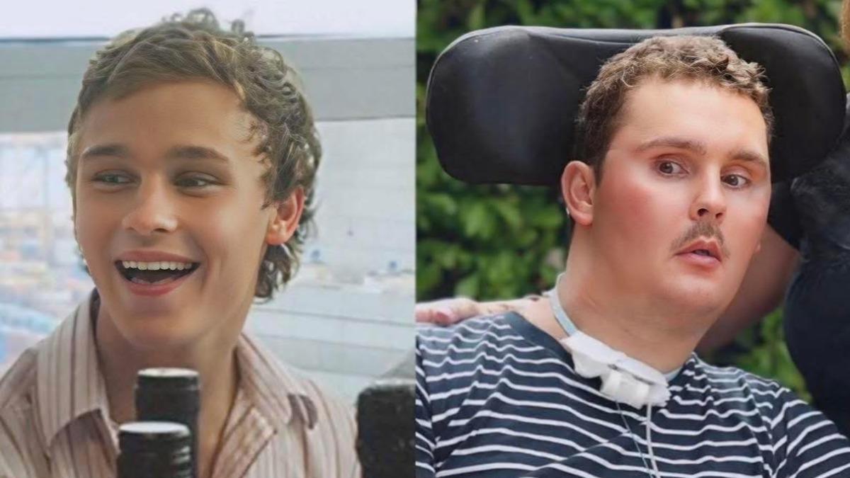 被朋友慫恿「生吞蛞蝓」!19歲少年昏迷420天 癱瘓8年病逝