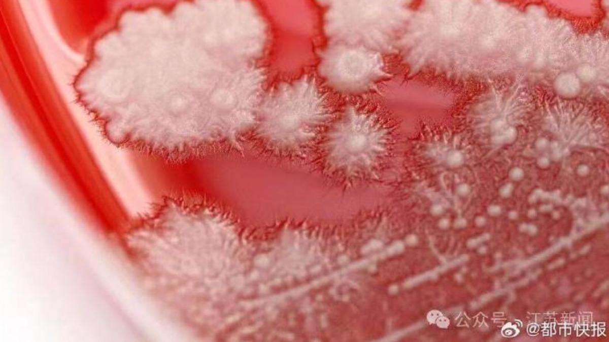 醫師幫張男照喉鏡後發現，其喉嚨內竟長滿白色雪花。（圖／翻攝自《都市快報》微博）