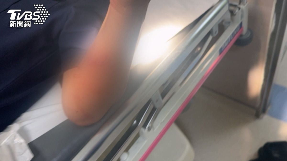 嫌犯衝撞巡邏車後又衝向員警,造成員警左手前臂受傷,需緊急送醫縫合。(圖/TVBS)