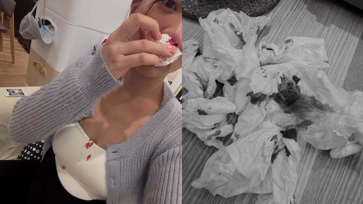 39歲女星懷孕暴氣「血崩狂流」! 一擦全染紅嚇壞老公:怕一屍兩命