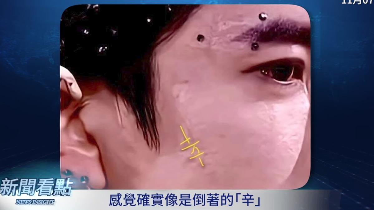 李沐陽披露于朦朧皮膚有疤的照片。（圖／翻攝自YouTube）