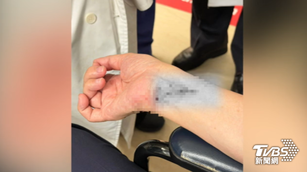 輔大醫院濺血!蘇一峰昔遭「揮拳咆哮」 病患動粗挨告後果曝