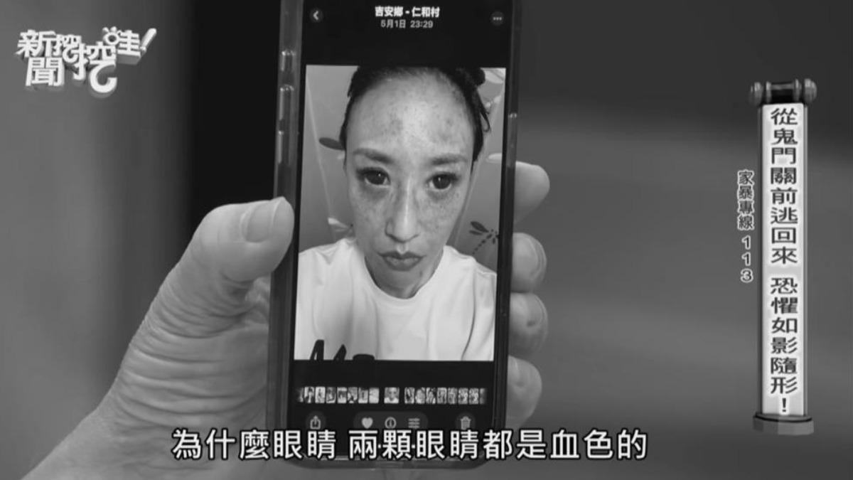 安歆澐被家暴照片。(圖/翻攝自新聞挖挖哇YT頻道)