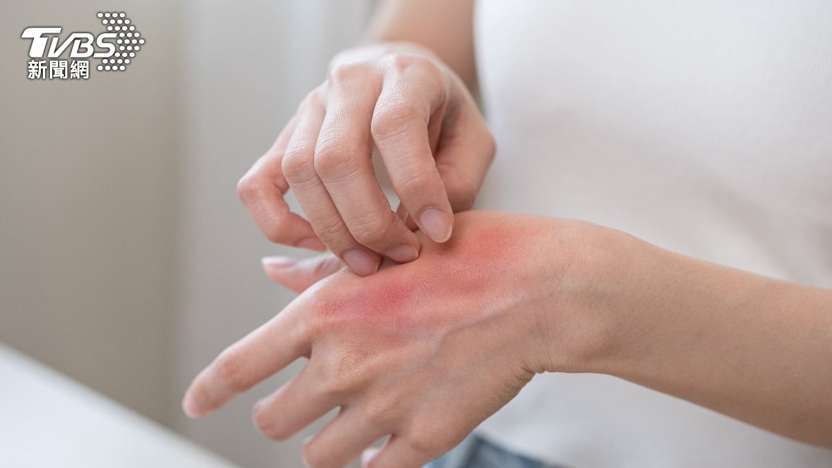 癢到睡不著?研究揭「薄荷醇」能抑制癢感 中醫大:全身都有效