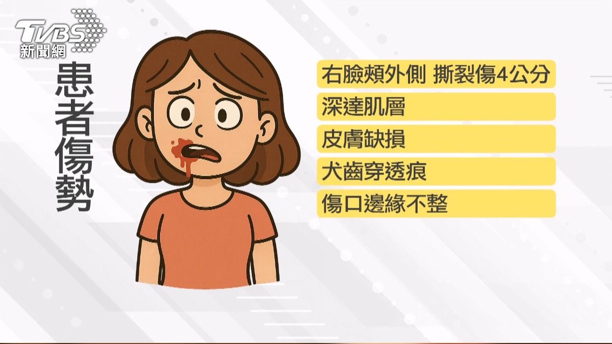 右臉頰外側有約4公分長的撕裂傷,皮膚缺損與犬齒穿透痕跡明顯。(圖/TVBS)