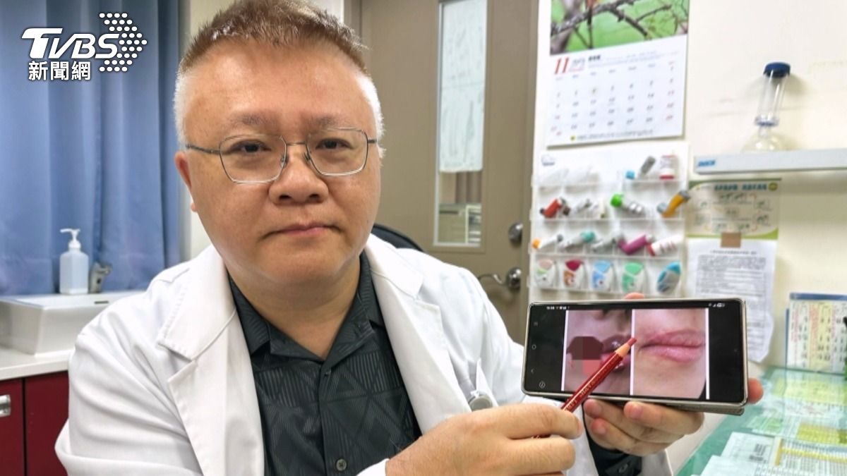 外科醫師將被咬掉的那塊組織要回來時,醫療團隊盡可能地將這塊組織縫合回去。(圖/TVBS)
