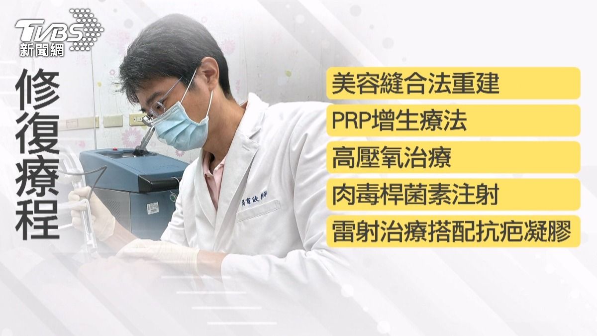 醫療團隊成功幫助這位女子重建面容,讓她重拾自信與笑容。(圖/TVBS)