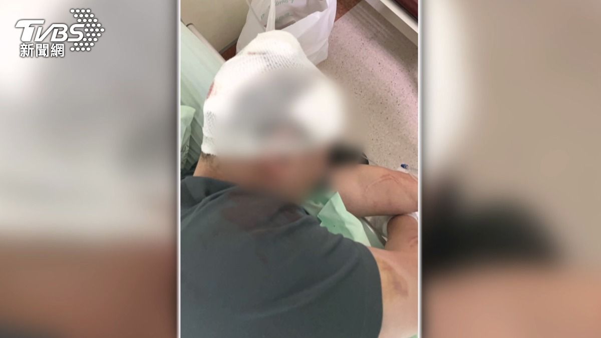 陳男的母親心疼地說,兒子手骨折了,頭部還縫了15針。(圖/民眾提供)