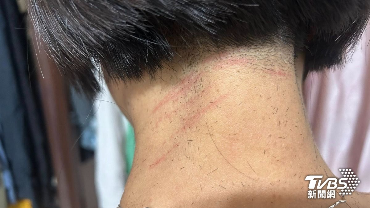 女子去知名連鎖快剪修頭髮,沒想到後頸驚見8道紅痕。(圖片來源/民眾提供)