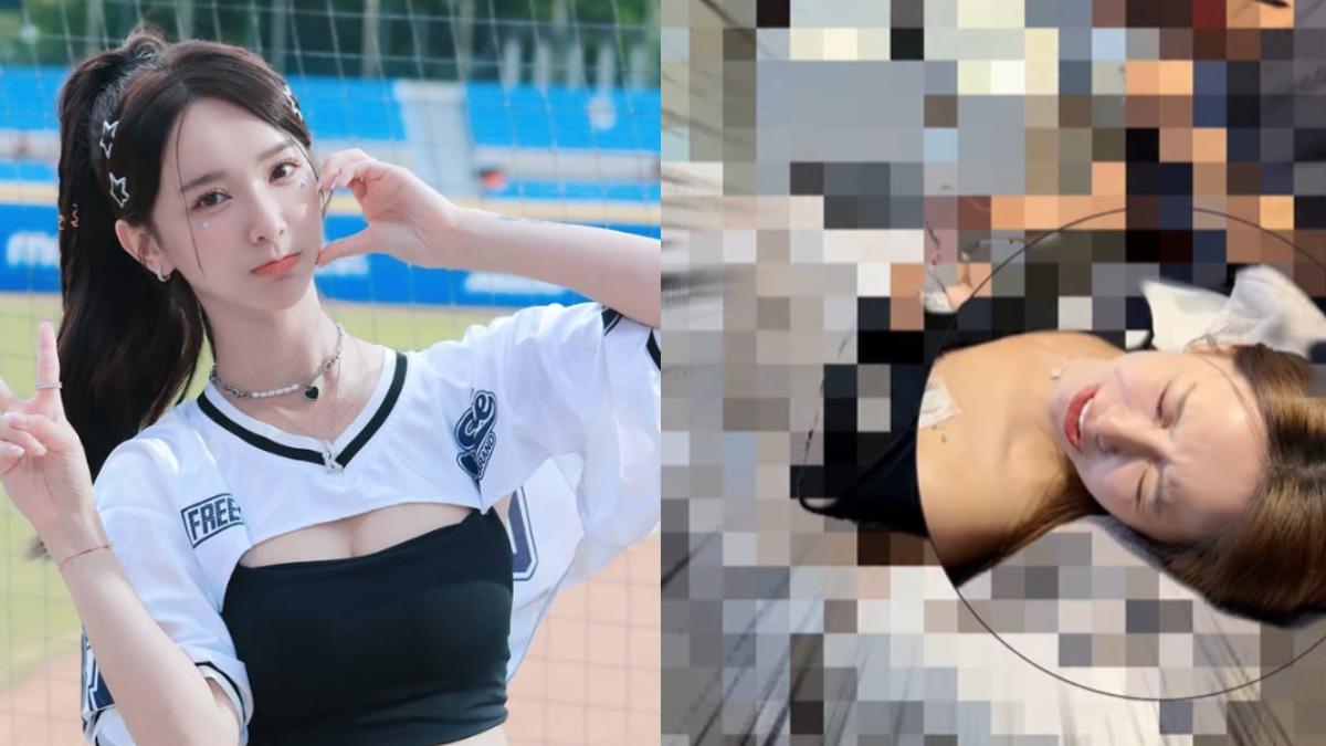 啦啦隊女神除刺青超煎熬!認了「影響工作」還身體乾淨 經紀人吐內幕