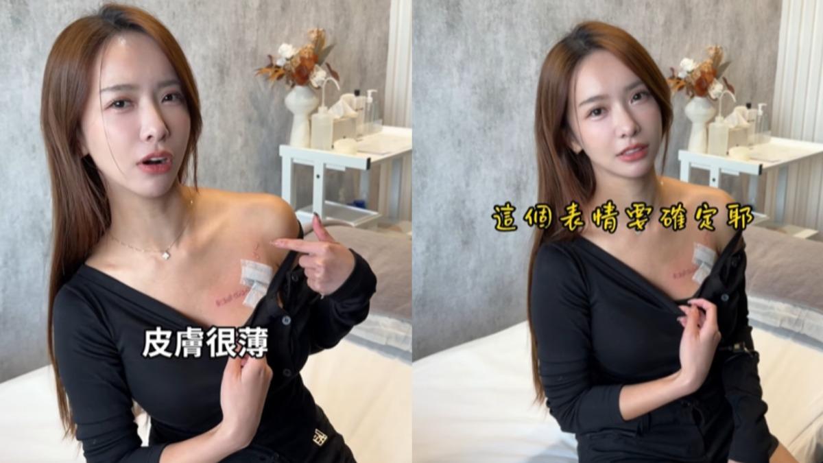 禾羽完成第一階段療程。(圖/翻攝自禾羽IG)
