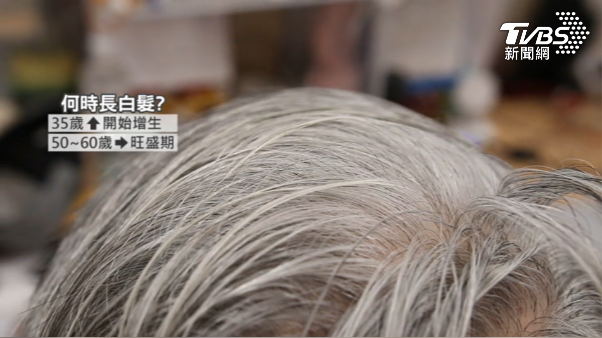 白頭髮原因， 醫師說和年紀、壓力、疾病及營養素有關。（圖／TVBS）