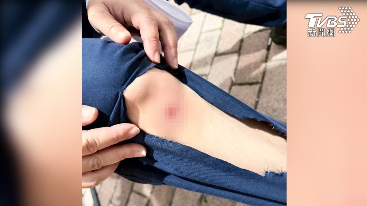 女警摔倒，右腳膝蓋和手指挫傷，這下不只要面臨違規擺攤，最高2千4百元的罰鍰（圖／TVBS）