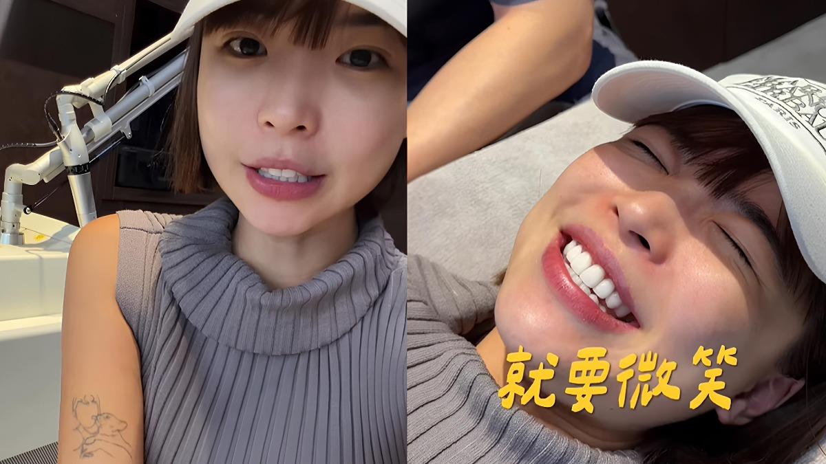 YTR阿圓除刺青過程全被拍!曝為何去除「愛犬」真實原因