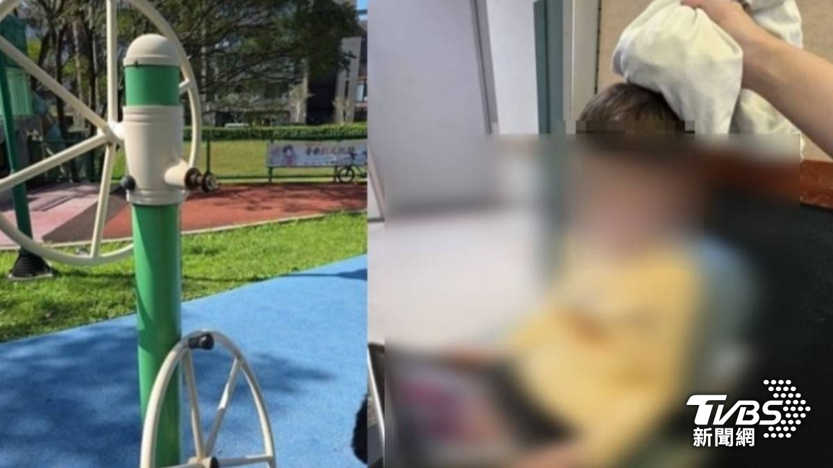 5歲童玩公園遊具慘被鐵圈砸頭,腫脹如「半顆茶葉蛋」。(圖/TVBS)