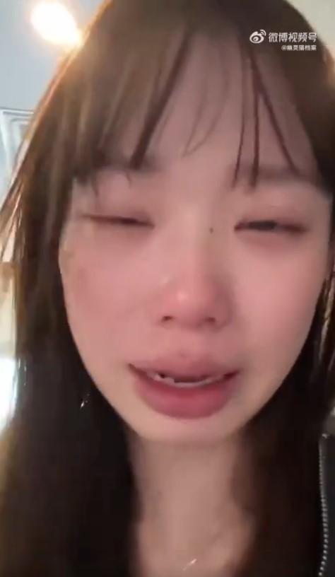 女子想給爸媽驚喜,結果嘴巴被門撞到破洞。(圖/翻攝自微博)