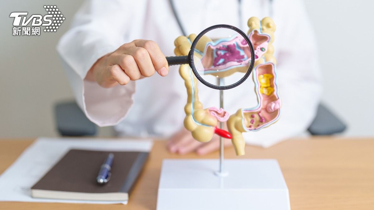 東野圭吾大腸癌病逝！醫曝5大前兆：出現2週快就醫