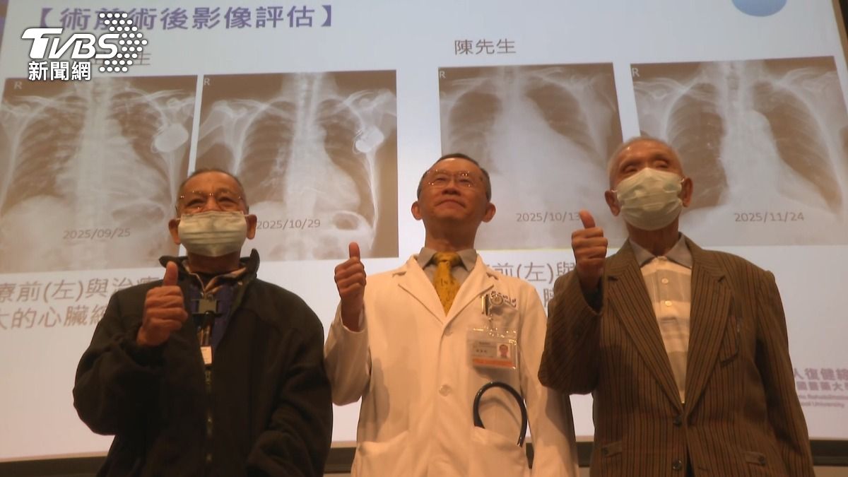 瓣膜修補手術安全性高、恢復快,民眾不必過度擔心手術風險。(圖/TVBS)
