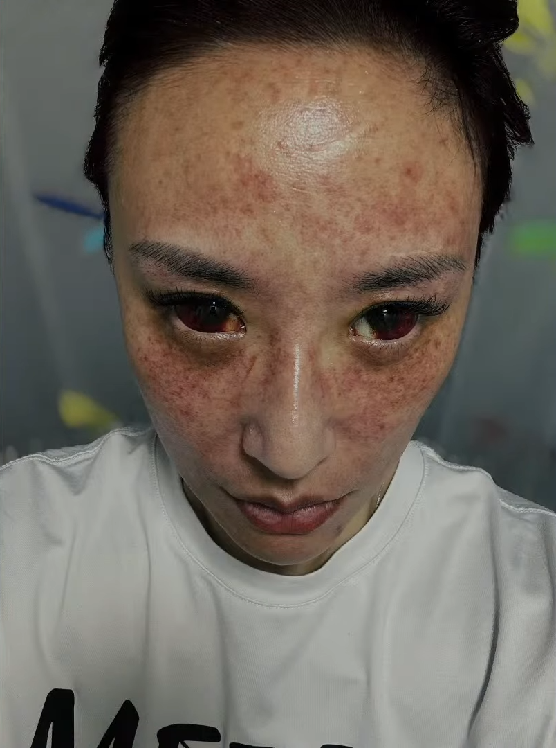 安歆澐,安歆澐不自殺聲明,安歆澐家暴,安歆澐腦缺氧,安歆澐婚變,安歆澐老公家暴,安歆澐老公外遇,安歆澐出軌,安歆澐老公莊英杰