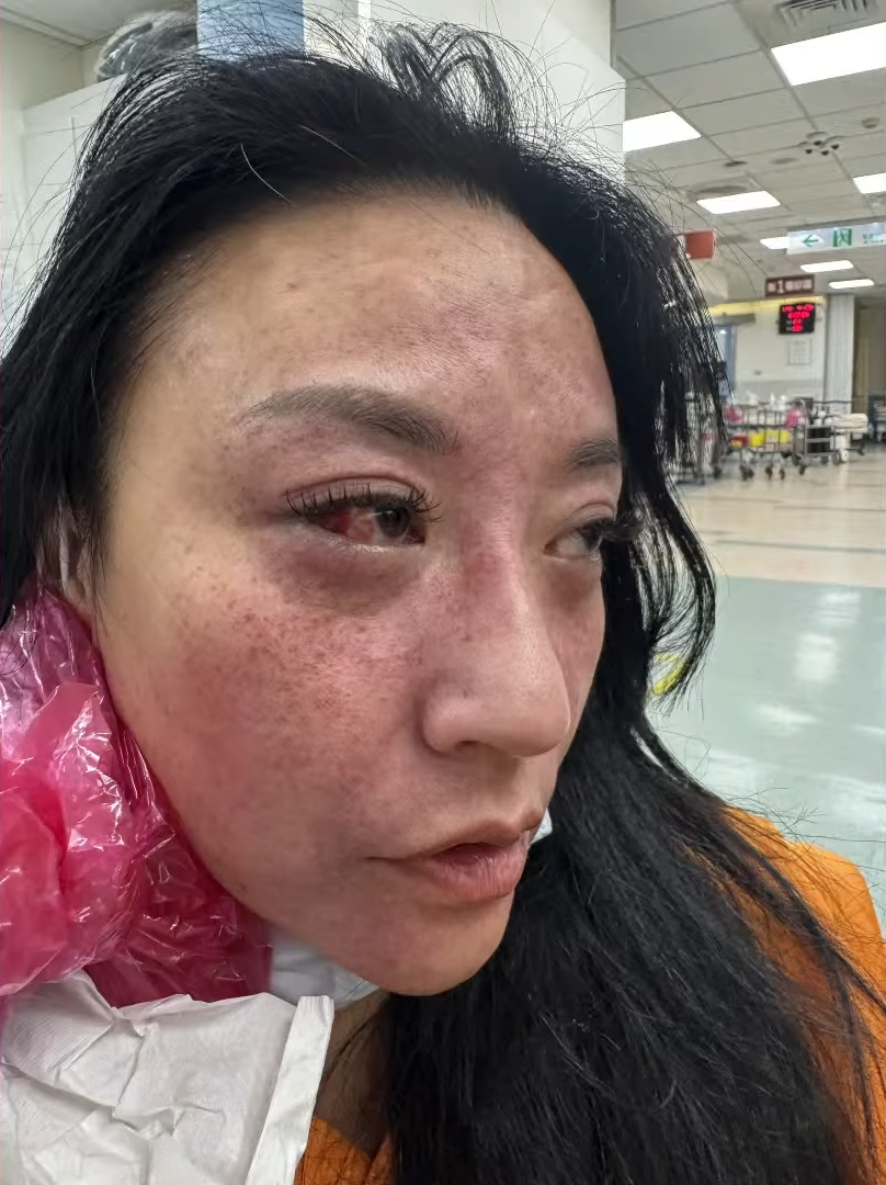 安歆澐,安歆澐不自殺聲明,安歆澐家暴,安歆澐腦缺氧,安歆澐婚變,安歆澐老公家暴,安歆澐老公外遇,安歆澐出軌,安歆澐老公莊英杰