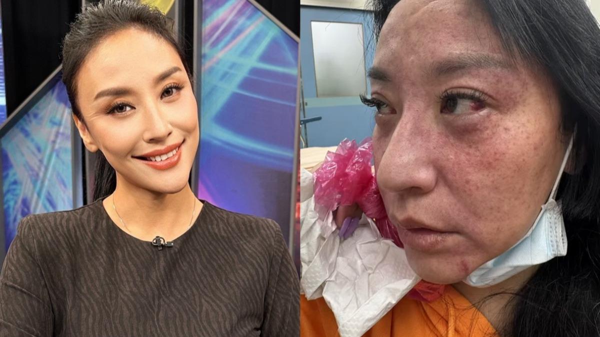 本土女星突「不自殺聲明」!尪持刀勒脖 腦缺氧血管爆裂
