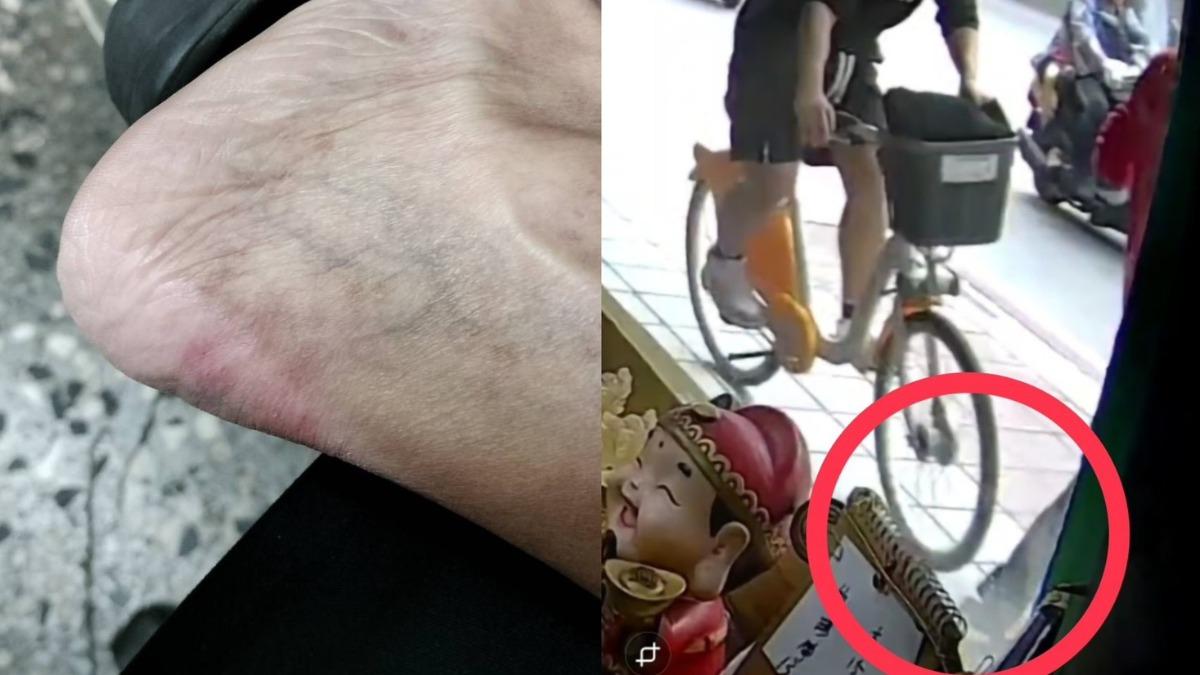 檳榔攤闆娘在人行道遭腳踏車撞傷後腳跟,對方還肇逃。(圖/當事民眾提供)