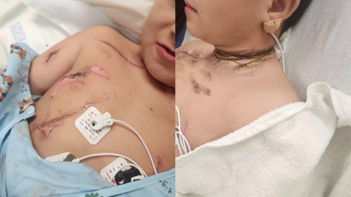 美8歲童睡夢翻身「項鍊卡插座」遭電擊 關鍵動作救回1命
