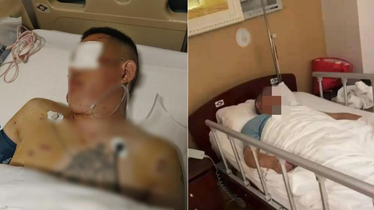 陸男剛領748萬就遇搶劫!左眼失明悲控:保全袖手旁觀