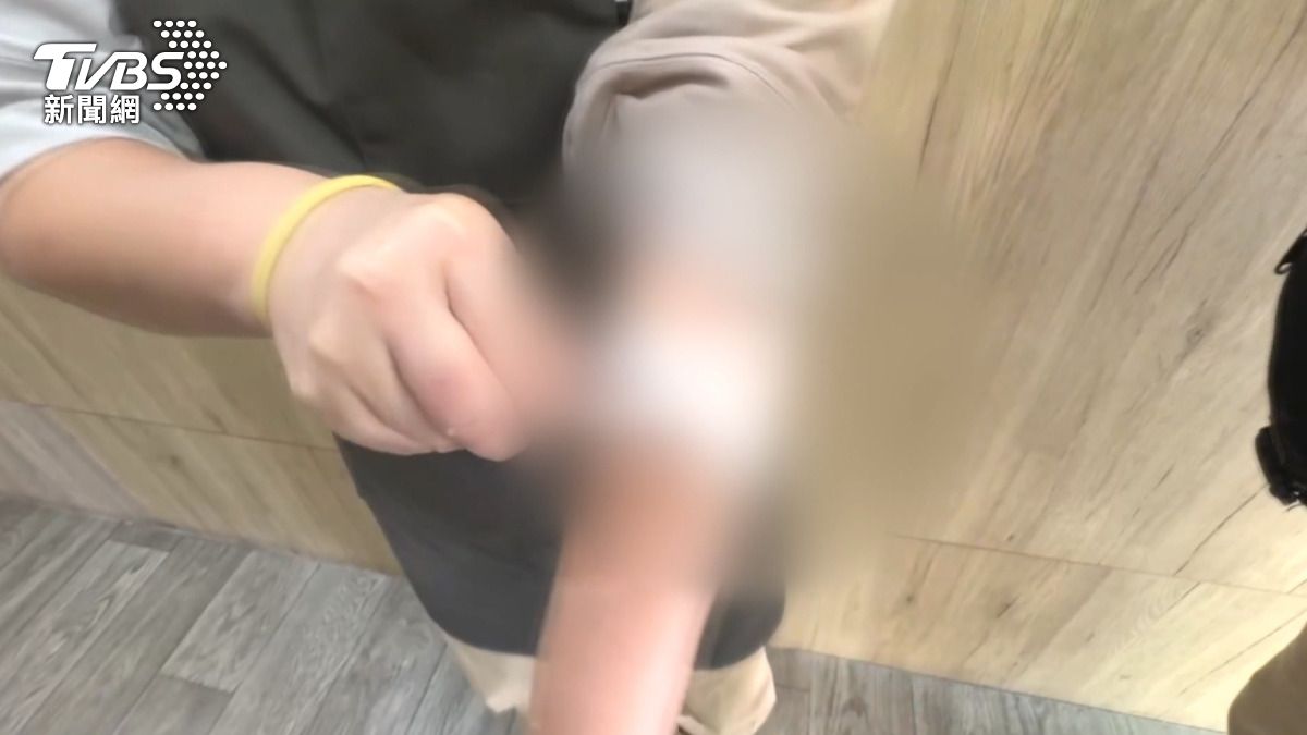 媽媽的左手臂雖然遭到劃傷,但她表示「還好,就這樣子而已」,並對路人的幫忙表達了感謝。(圖/民眾提供)
