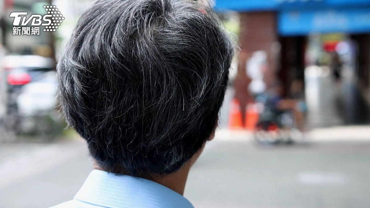 白髮越拔越多?醫師警告:頭皮恐發炎受傷(圖/TVBS)