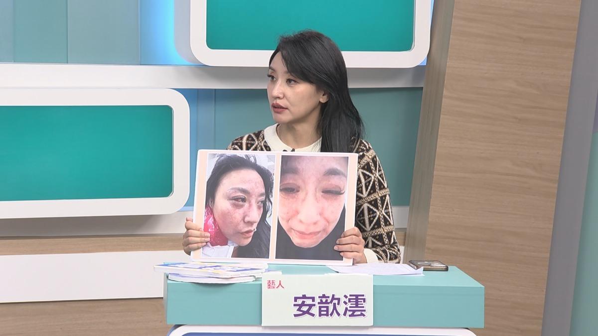 安歆澐被家暴，申請保護令。（圖／和展影視提供）
