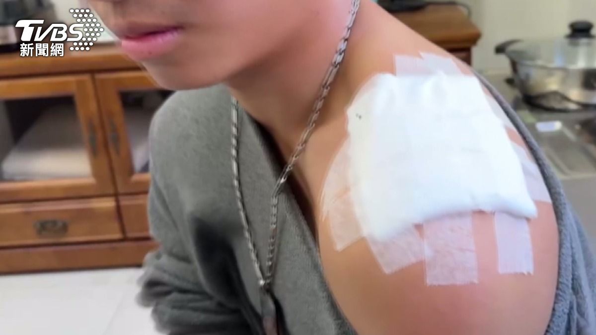 19歲的警專學員鄭同學表示他的肩膀、腳踝、膝蓋都有傷,手部則是因為後來撐地板而受傷。(圖/TVBS)