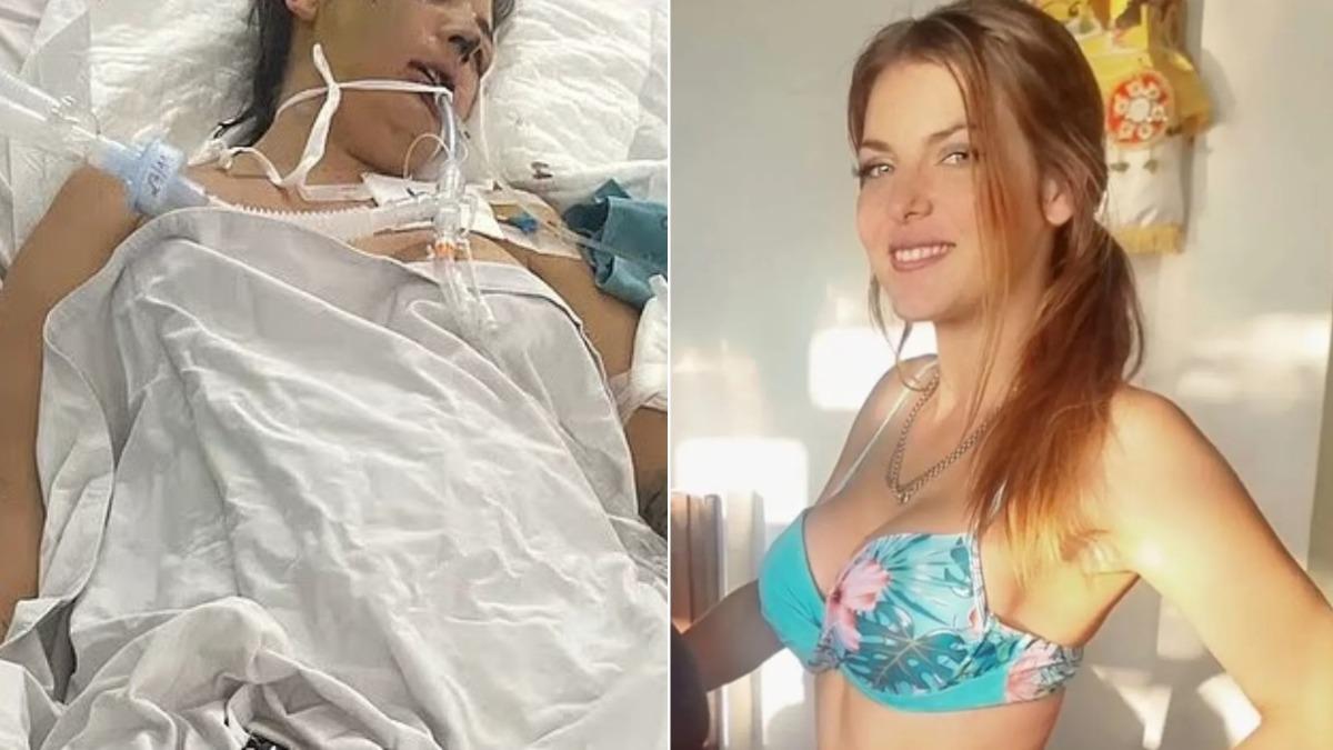 澳洲3寶媽飛越南整形　隔天「突昏迷+器官衰竭」險客死異鄉