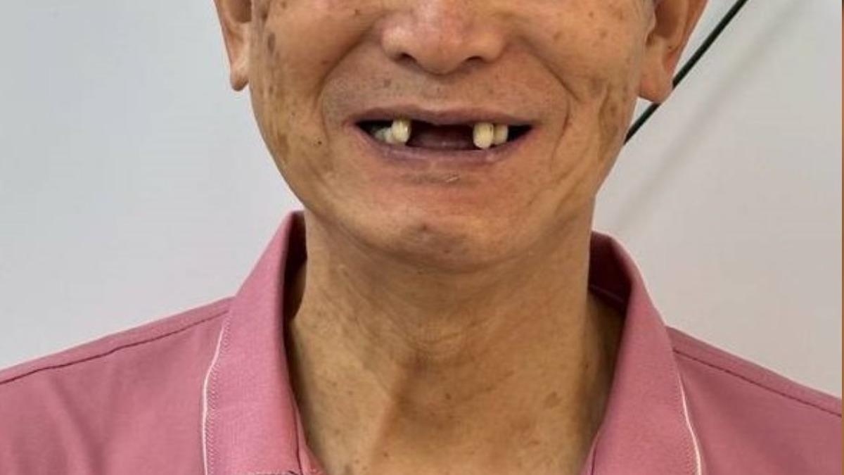 吃飯就痛嘴又臭!台中男不願治能拖就拖 張口見「牙全爛光」