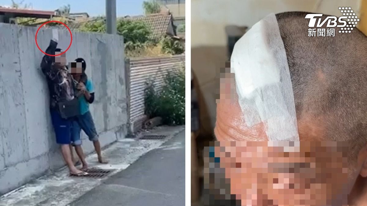 不爽鄰居!雲林男「曾喊我要砍你」菜刀劈頭 5cm撕裂傷炸血