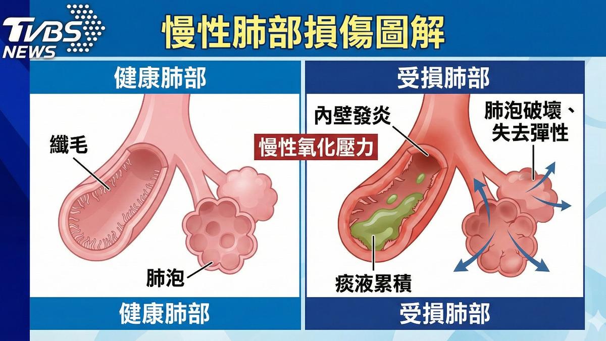 小心!劇烈溫差 醫師:肺阻塞易發病增死亡風險 (圖/TVBS)