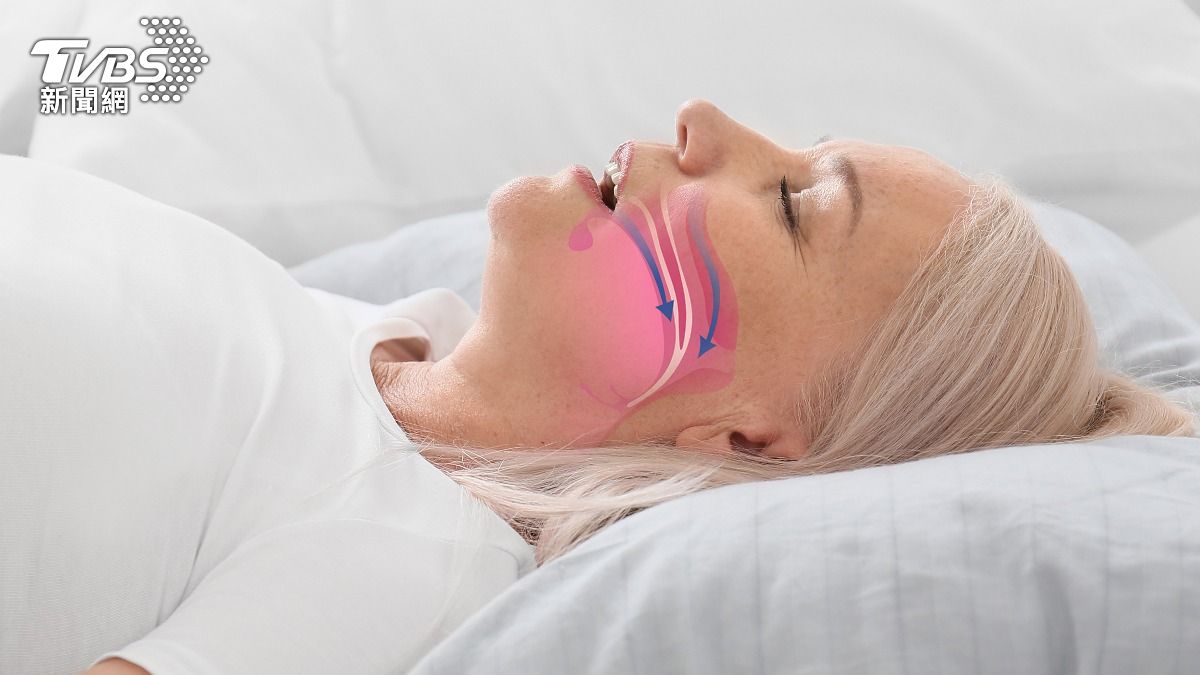 用嘴呼吸恐引發睡眠呼吸中止!醫曝「5大危害」:恐變醜、易生病