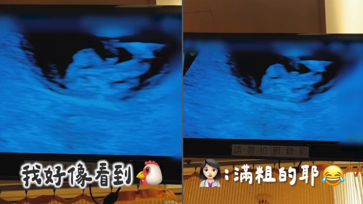 瑀熙與老公一同前往產檢，她「兒女雙全」的心願破碎。（圖／翻攝自IG＠uccu0323）