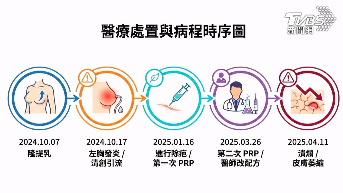 去年10月7號進行隆提乳手術後,左胸發炎高燒,1月進一步要除疤,施打PRP高濃度血小板血漿,沒想到右胸開始發癢,皮膚出現萎縮和潰爛(圖/TVBS)