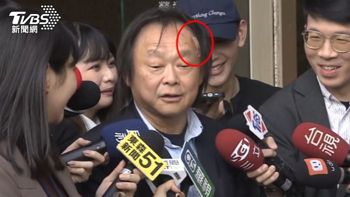 在家做伏地挺身遭愛貓突襲,民進黨立委王世堅不慎撞傷額頭。(圖/TVBS)