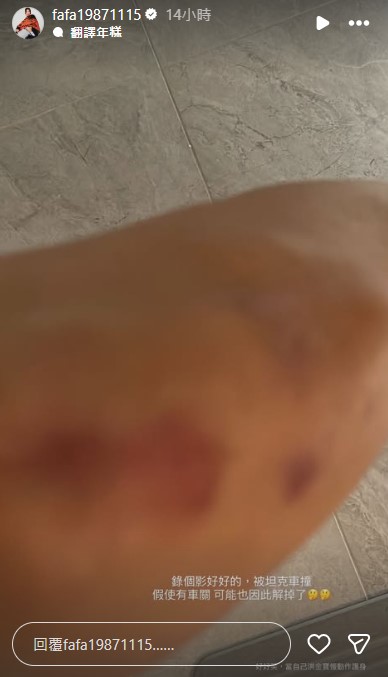 豆花妹自嘲是洪金寶,笑說受傷當下還試圖用慢動作護身。(圖/翻攝自「@fafa19871115」IG)