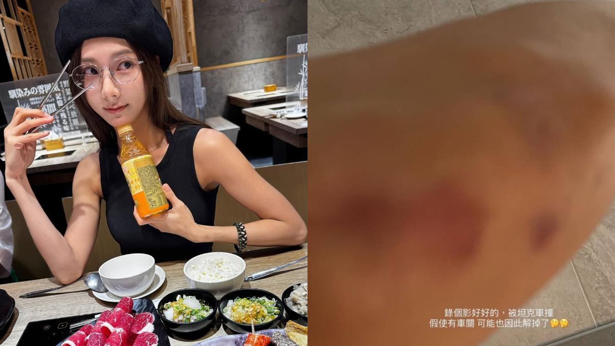 豆花妹自曝錄影時遭坦克車撞，身上出現超大一片瘀青。（圖／翻攝自「@fafa19871115」IG）