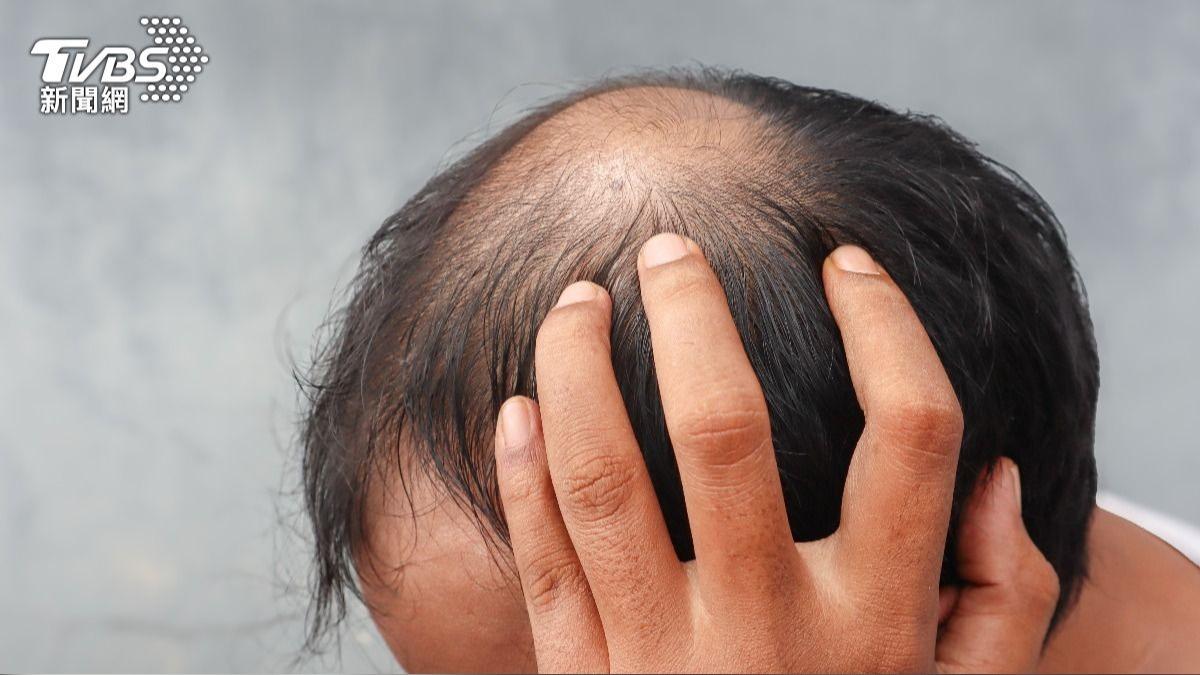 示意圖/達志影像shutterstock
