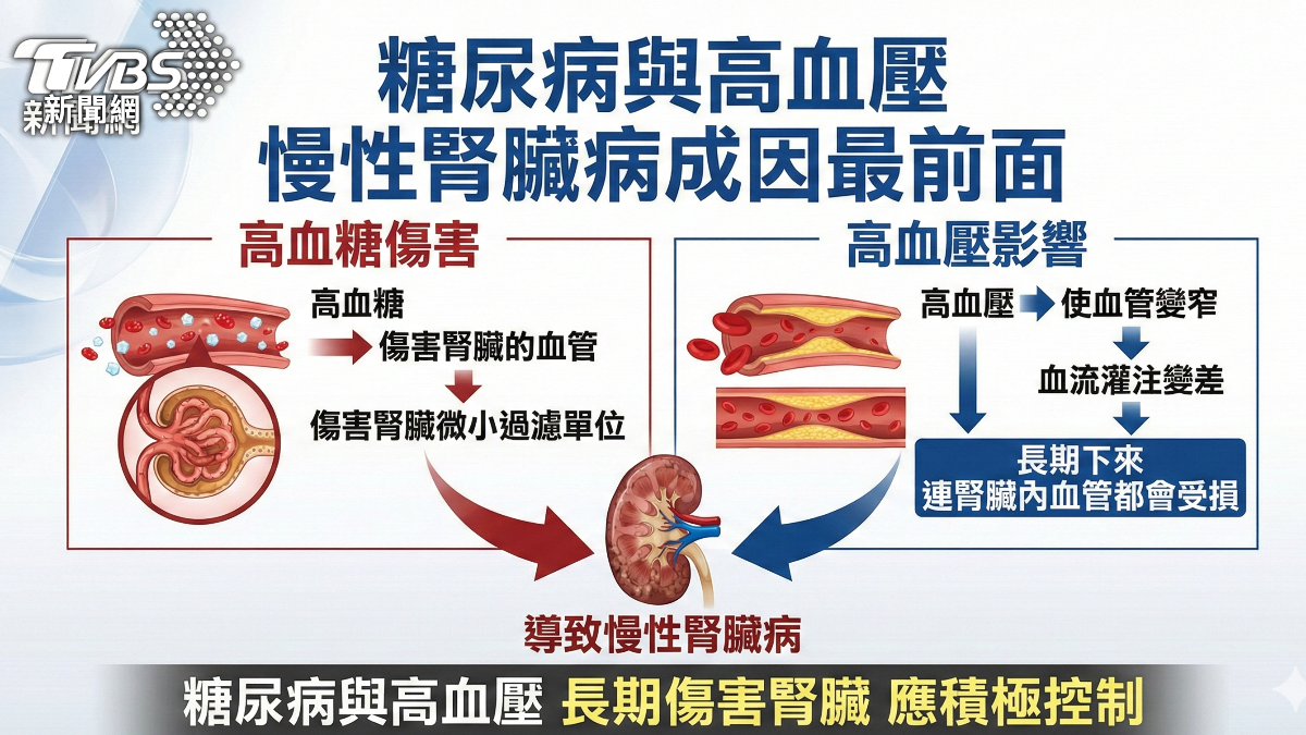 注意!慢性腎臟病早期無感 三高失控加速惡化 (圖/TVBS)