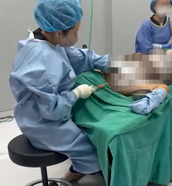 白委陳昭姿今(24)日指出,有知名醫美診所由非醫師身分之護理人員執行抽脂。(圖/陳昭姿提供)