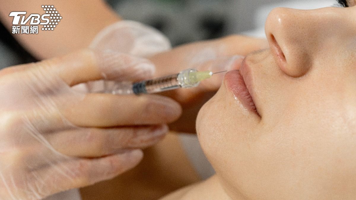 不過度追求完美!醫曝「不被發現」的醫美關鍵 擺脫僵硬塑膠臉