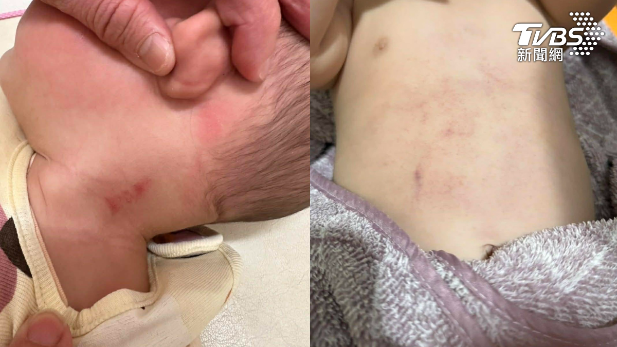台南保母虐11月嬰21次!踩腹、重摔致腦部重傷 提百萬交保遭駁