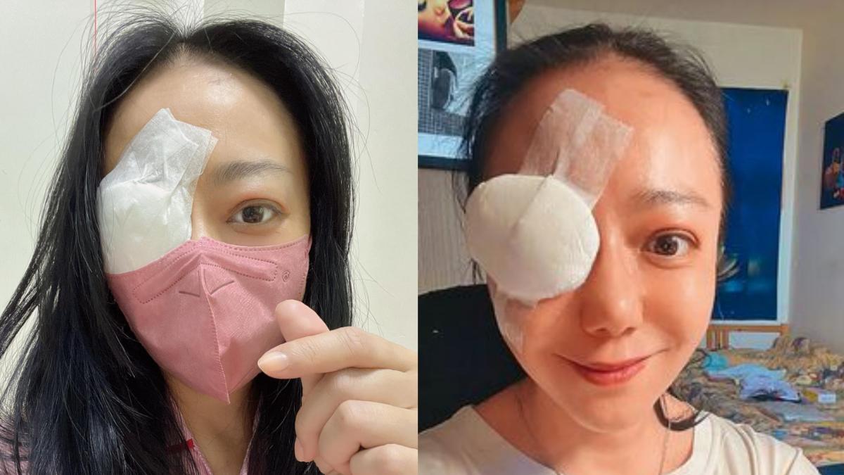 高慧君眼珠翻出恐失明 做好「最壞打算」:剩最後1次手術了